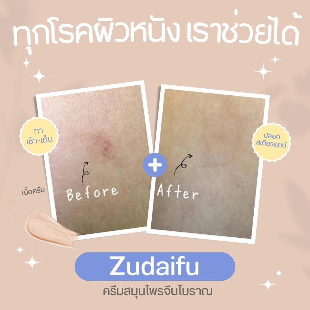 Zudaifu Herbal Skin Care Cream – 15 g.