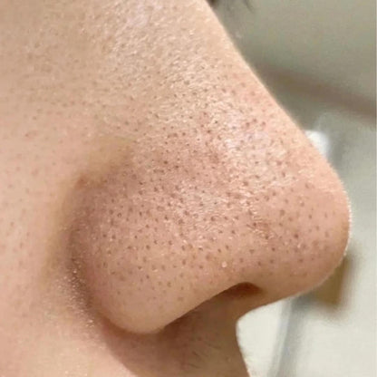 Nakiz Lively Nose Premium Blackhead Remover – 15 g