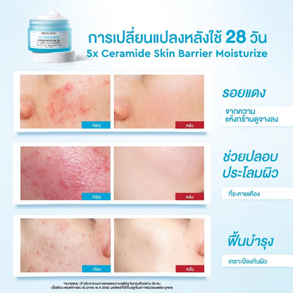 SKINTIFIC 5X Ceramide Moisture Gel Moisturizer – 30 g