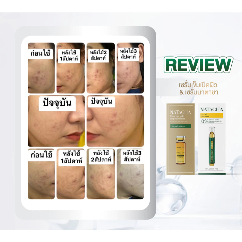 Natasha R-EX2 Ampoule Skin Booster Serum – 1 Sachet