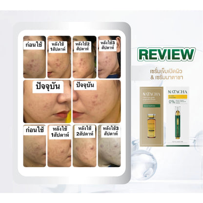 Natasha R-EX2 Ampoule Skin Booster Serum – 1 Sachet