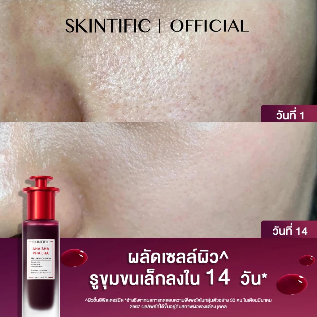 SKINTIFIC AHA BHA PHA LHA Peeling Solution Serum Essence – 30 ml