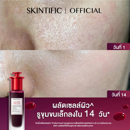 SKINTIFIC AHA BHA PHA LHA Peeling Solution Serum Essence – 30 ml