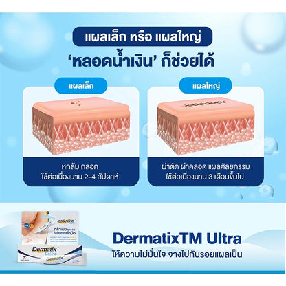 Dermatix Ultra Silicone Scar Reduction Gel – 15 g | Suvaree Sydney